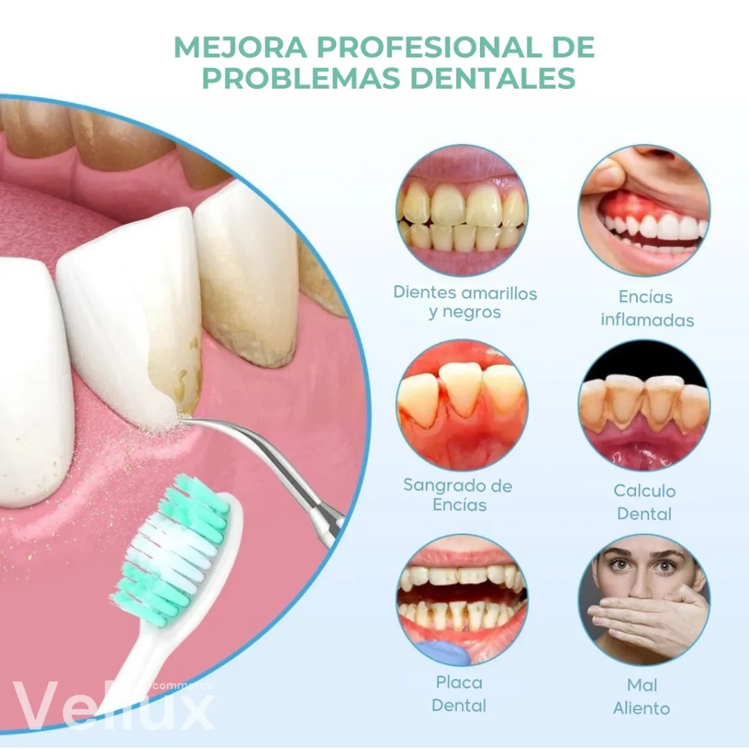 Miniatura 2 de REMOVEEDOR SARRO DENTAL